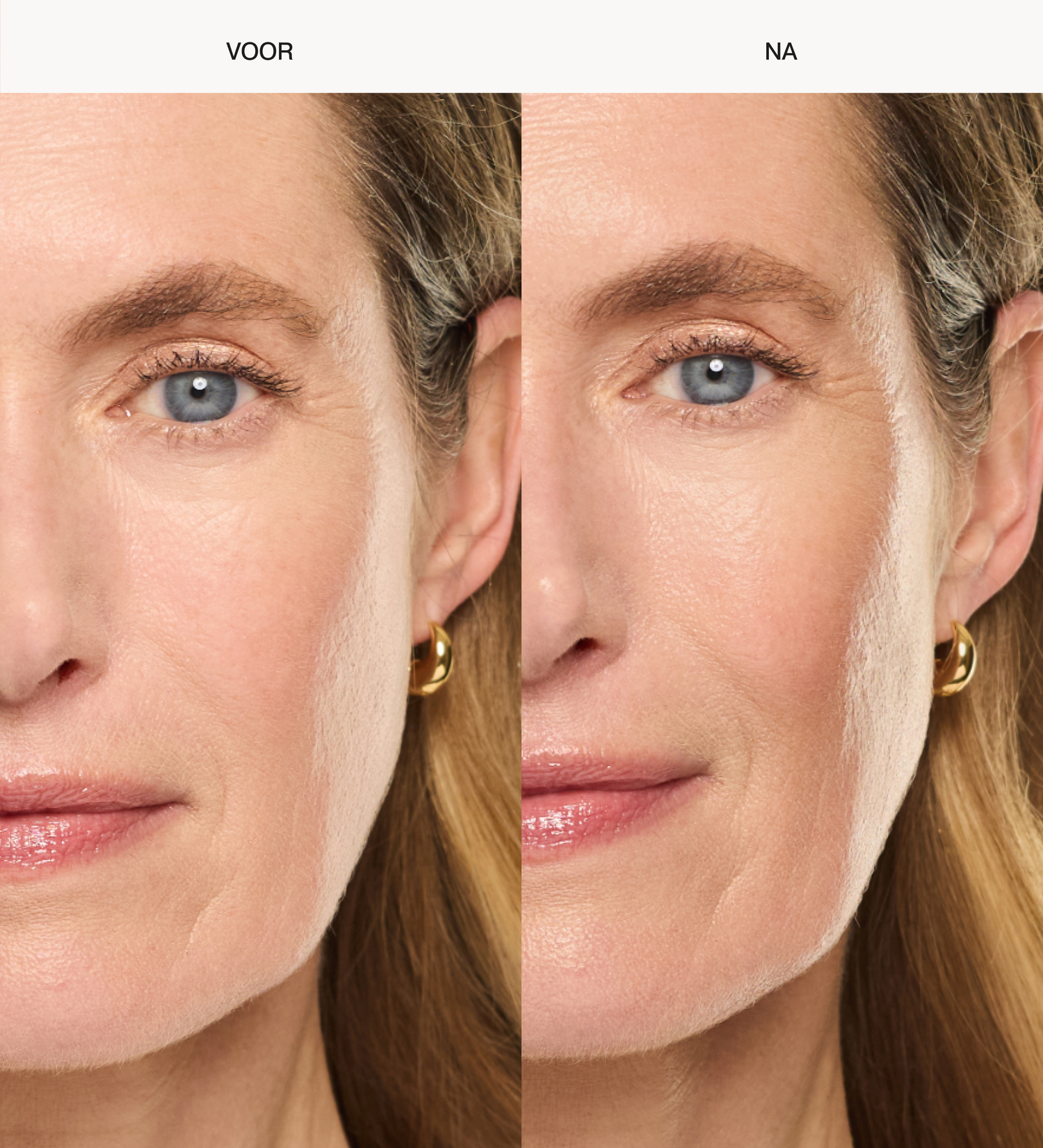 Voor en na resultaat van Daily Face SPF 40 op een rijpe huid voor een gladde en gehydrateerde finish.