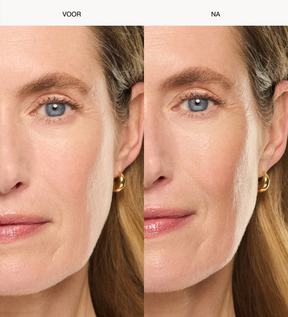 Voor en na resultaat van Daily Face SPF 40 op een rijpe huid voor een gladde en gehydrateerde finish.